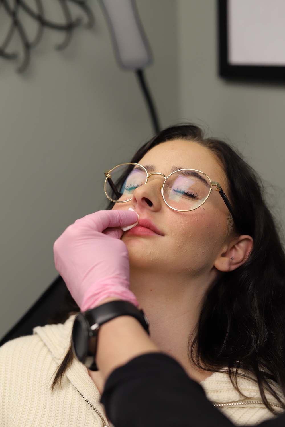 Lip filler treatment
