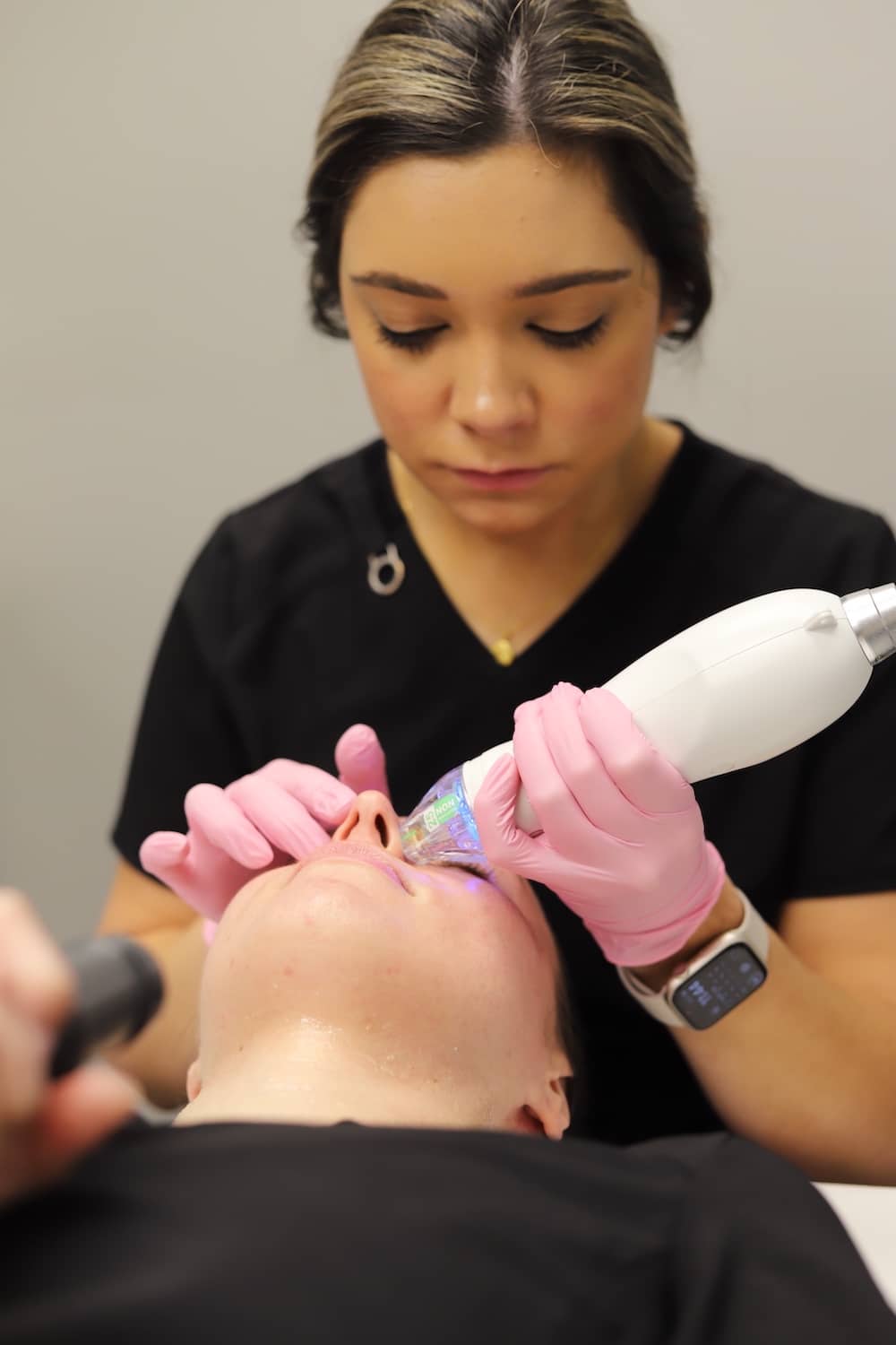 Secret RF treatment