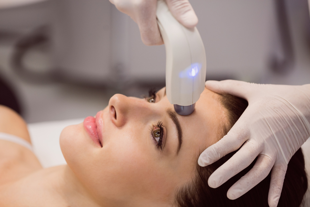 Laser treatments before and after in Knoxville, TN at Skin & Sculpt Med Spa