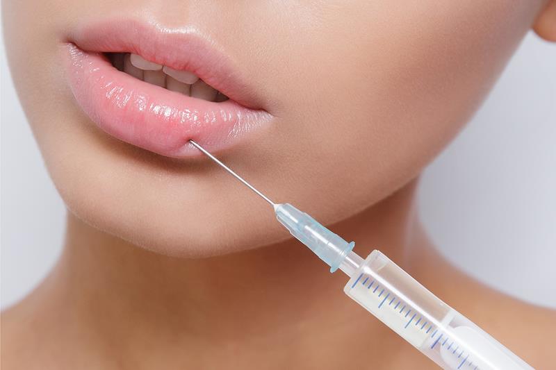 JUVÉDERM dermal fillers before and after in Knoxville, TN at Skin & Sculpt Med Spa