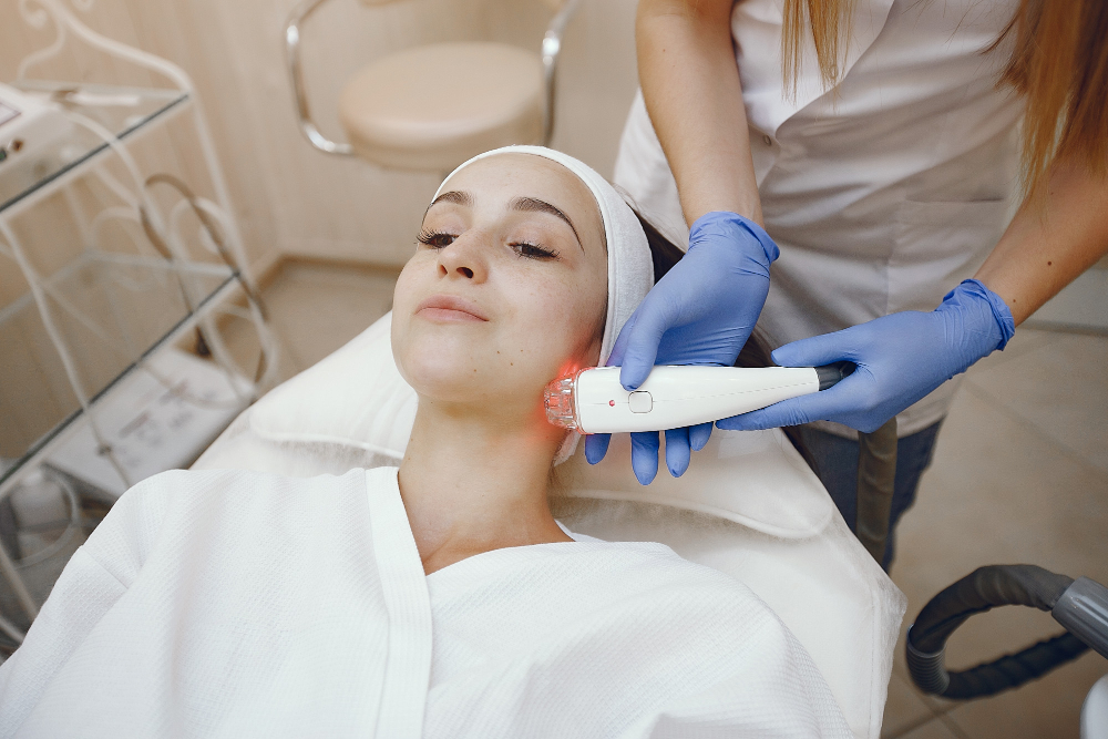 LimeLight IPL photofacial results in Maryville, TN