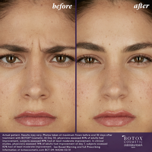 BOTOX-Cosmetic-Professional-Team-Diversity-BAs-Gia-3